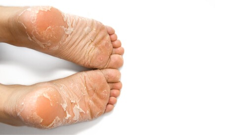 ما تفسير ازالة الجلد الميت من القدم في المنام لابن سيرين؟